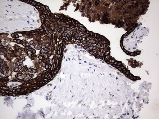 Monoclonal Rat anti-Human Acidic Cytokeratin Antibody (clone 9H3, IHC)