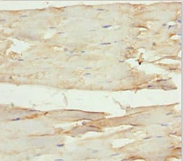 SLC1A5 / ASCT2 Antibody