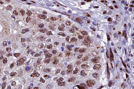 XRCC3 Antibody