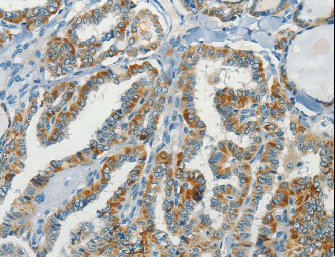 Polyclonal Rabbit anti-Human C15orf2 Antibody (IHC)
