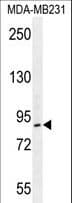 Polyclonal Rabbit anti-Human KAT2B / PCAF Antibody (aa253-283, WB)