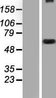 WDR34 Protein (Over-Expression Lysate Myc-DDK (Flag))