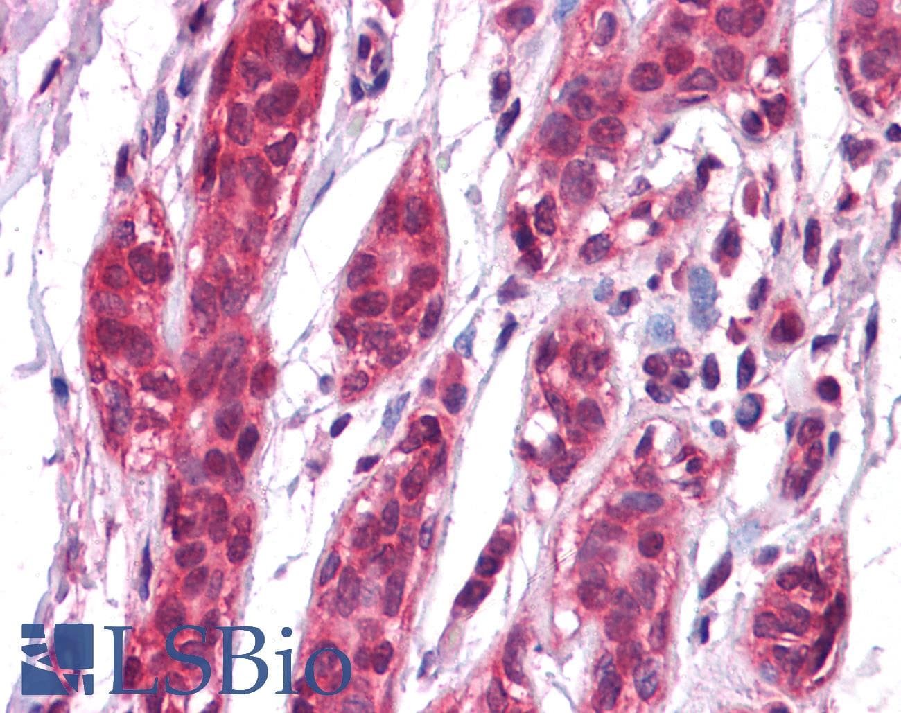 IHC-plus™ EPHA7 / EPH Receptor A7 Antibody (clone 6C8G7)