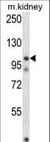 Polyclonal Rabbit anti-Human FSTL5 Antibody (aa20-48, WB)