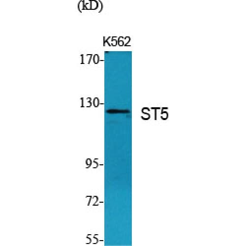 Polyclonal Rabbit anti-Human HTS1 / ST5 Antibody (380-460 aa, Internal, WB)