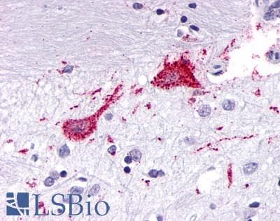 PathPlus™ KISS1R / GPR54 Antibody (Cytoplasmic Domain)