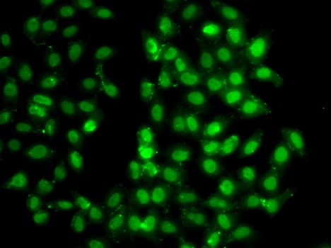 PSMD8 / RPN12 Antibody