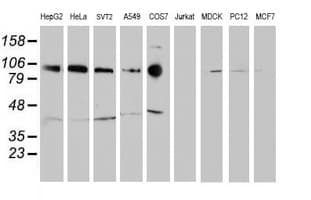 CDH2 / N Cadherin Antibody (clone OTI2G7)