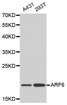 Polyclonal Rabbit anti-Human ARF6 Antibody (IHC, WB)