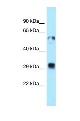 Polyclonal Rabbit anti-Human TXNDC1 / TMX1 Antibody (C-Terminus, WB)