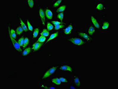 IHC-plus™ MYH9 Antibody (aa 2-241)