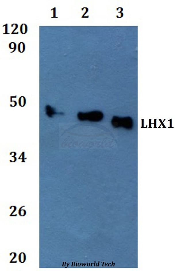 LHX1 Antibody