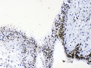 HMG1 / HMGB1 Antibody