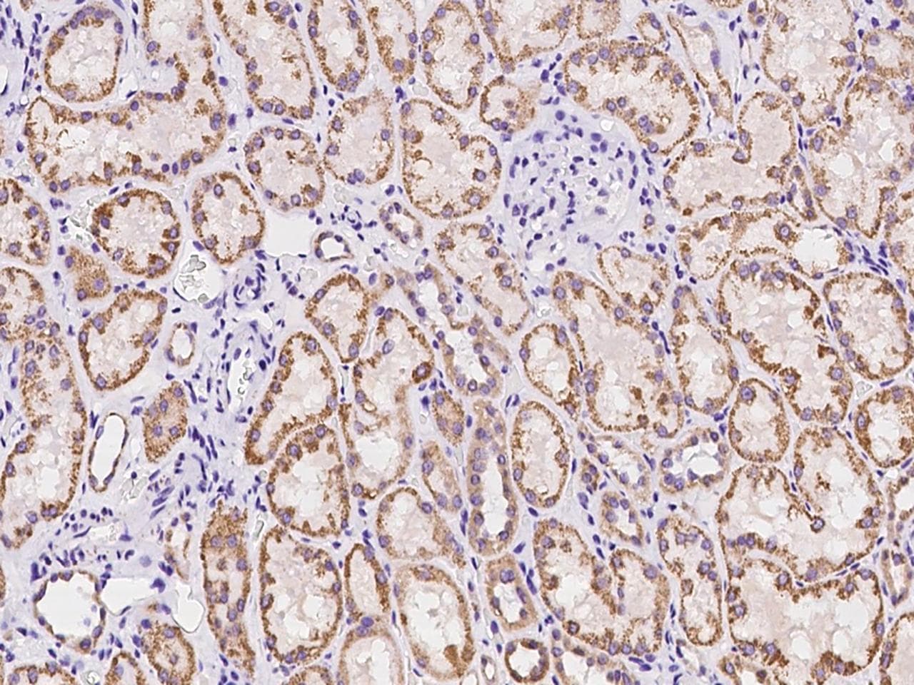 ARHGAP22 / RhoGAP2 Antibody