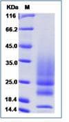 Human IL22 Protein (Recombinant His,C-terminus)