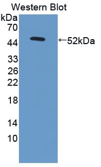 LAMC3 / Laminin Gamma 3 Antibody (aa901-1100)