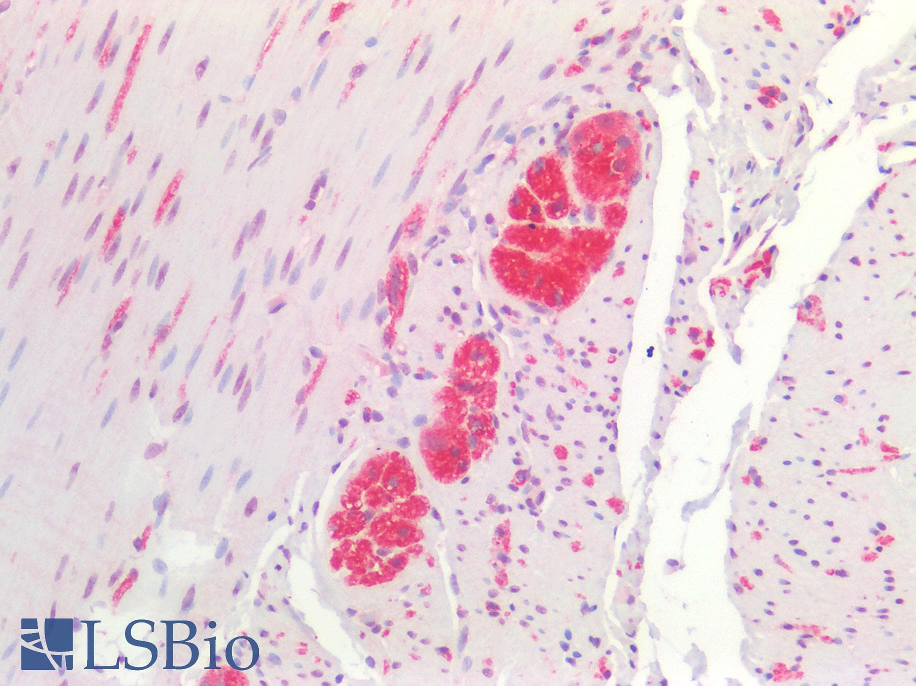 IHC-plus™ ACHE / Acetylcholinesterase Antibody