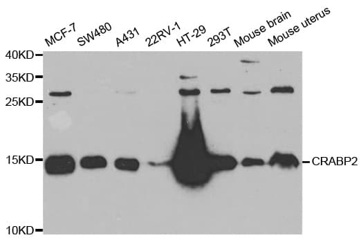 Polyclonal Rabbit anti-Human CRABP2 Antibody (IHC, IF, WB)