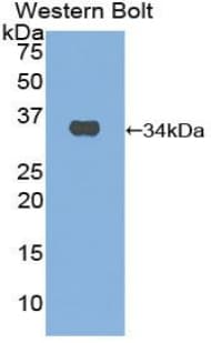 MMP7 / Matrilysin Antibody (aa1-267)