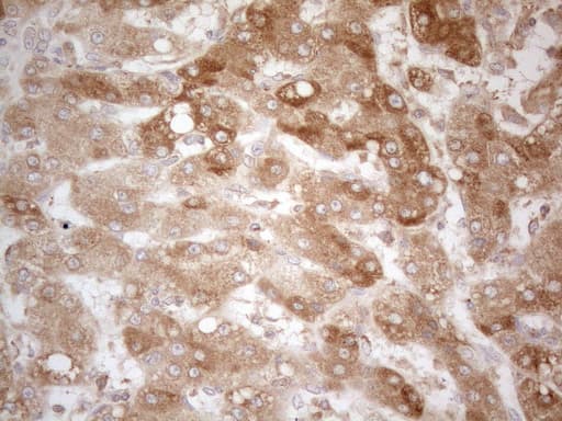 TNFRSF10B / Killer / DR5 Antibody (aa203-411, clone OTI2A5)