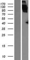 APOER2 / LRP8 Protein (Over-Expression Lysate Myc-DDK (Flag))