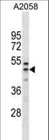 Polyclonal Rabbit anti-Human RFFL Antibody (aa265-294, WB)