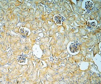 ANXA3 / Annexin A3 Antibody