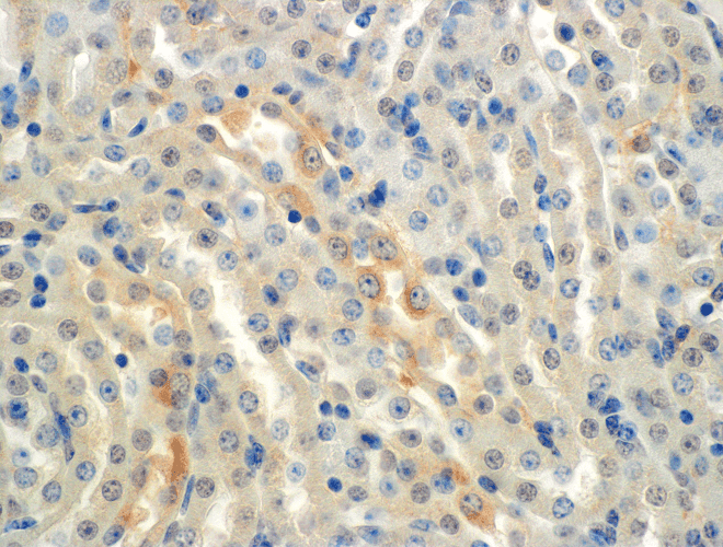 SCNN1A / ENaC Alpha Antibody (clone 2G4)