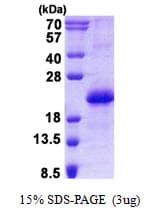 Human CNBP / ZNF9 Protein (Recombinant His)