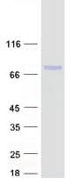 Human DDX59 Protein (Recombinant Myc-DDK (Flag))