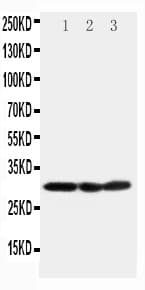 COMT Antibody (aa94-108)
