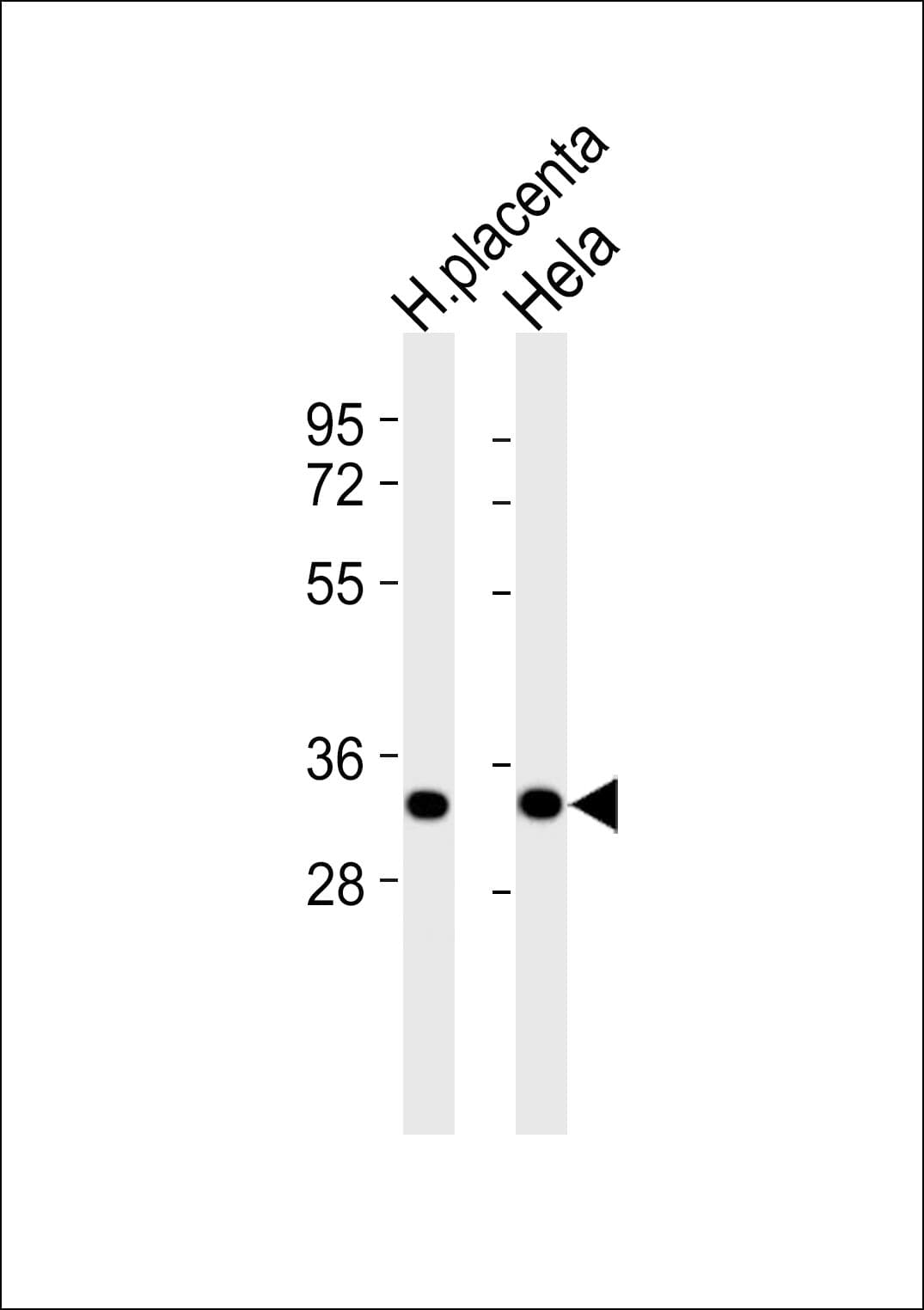 ANXA3 / Annexin A3 Antibody