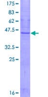 Human SSPN / Sarcospan Protein (Recombinant GST)
