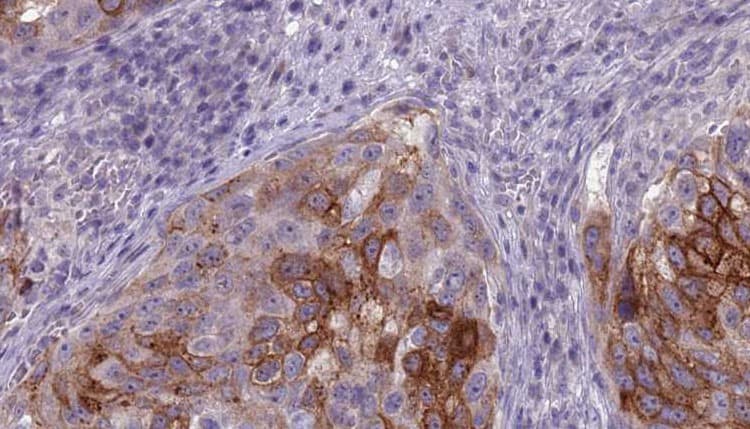 ATP6V1B1 Antibody