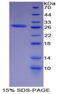 Mouse ERBB2 / HER2 Protein (Recombinant His-T7)