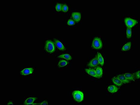 TOR1A / Torsin A Antibody