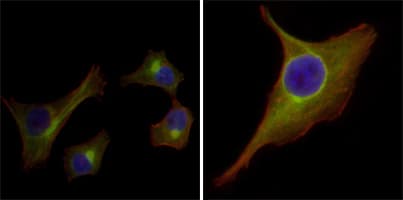 IHC-plus™ KRT15 / CK15 / Cytokeratin 15 Antibody (clone 6E7)