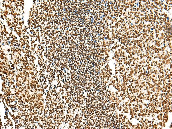 HABP4 Antibody