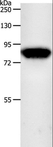 Polyclonal Rabbit anti-Human INA / Alpha Internexin Antibody (IHC, WB)