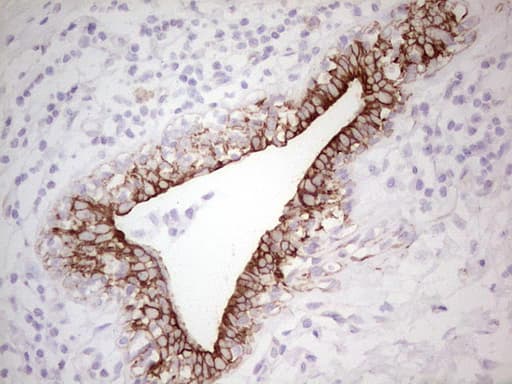 ABCB1 / MDR1 / P Glycoprotein Antibody (aa995-1280, clone OTI11D2, Carrier-free)