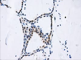 Monoclonal Mouse anti-Human DCXR Antibody (clone OTI7D11, IHC, WB)