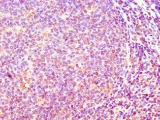 ACTR3B / ARP4 Antibody (aa189-418)
