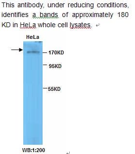 TOP2B / Topoisomerase II Beta Antibody