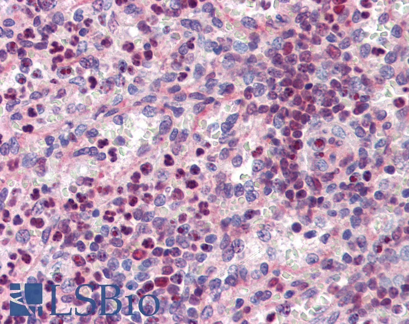IHC-plus™ SPI1 / PU.1 Antibody (aa27-37)