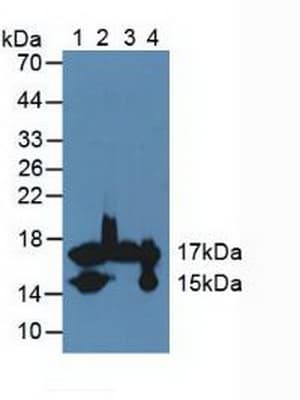 FABP4 / AP2 Antibody