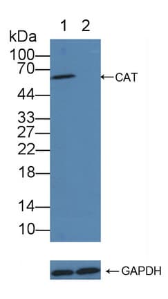 Polyclonal Rabbit anti-Human CAT / Catalase Antibody (aa401-523, WB)