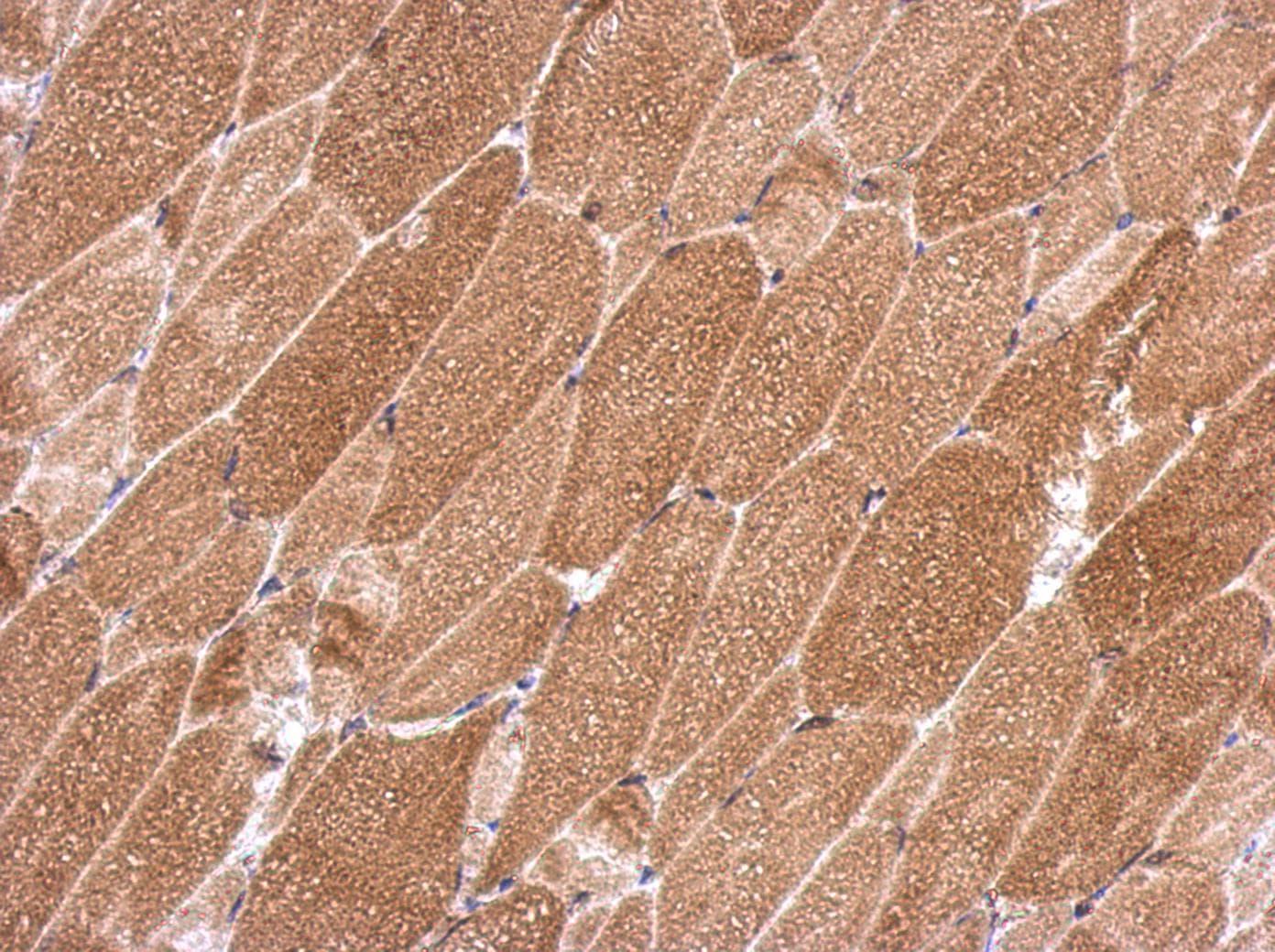 Polyclonal Rabbit anti-Human KCTD19 Antibody (IHC, WB)