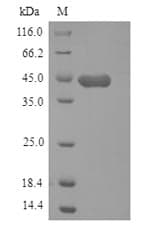 Mouse HAPLN1 Protein (Recombinant 6His, N-terminus)