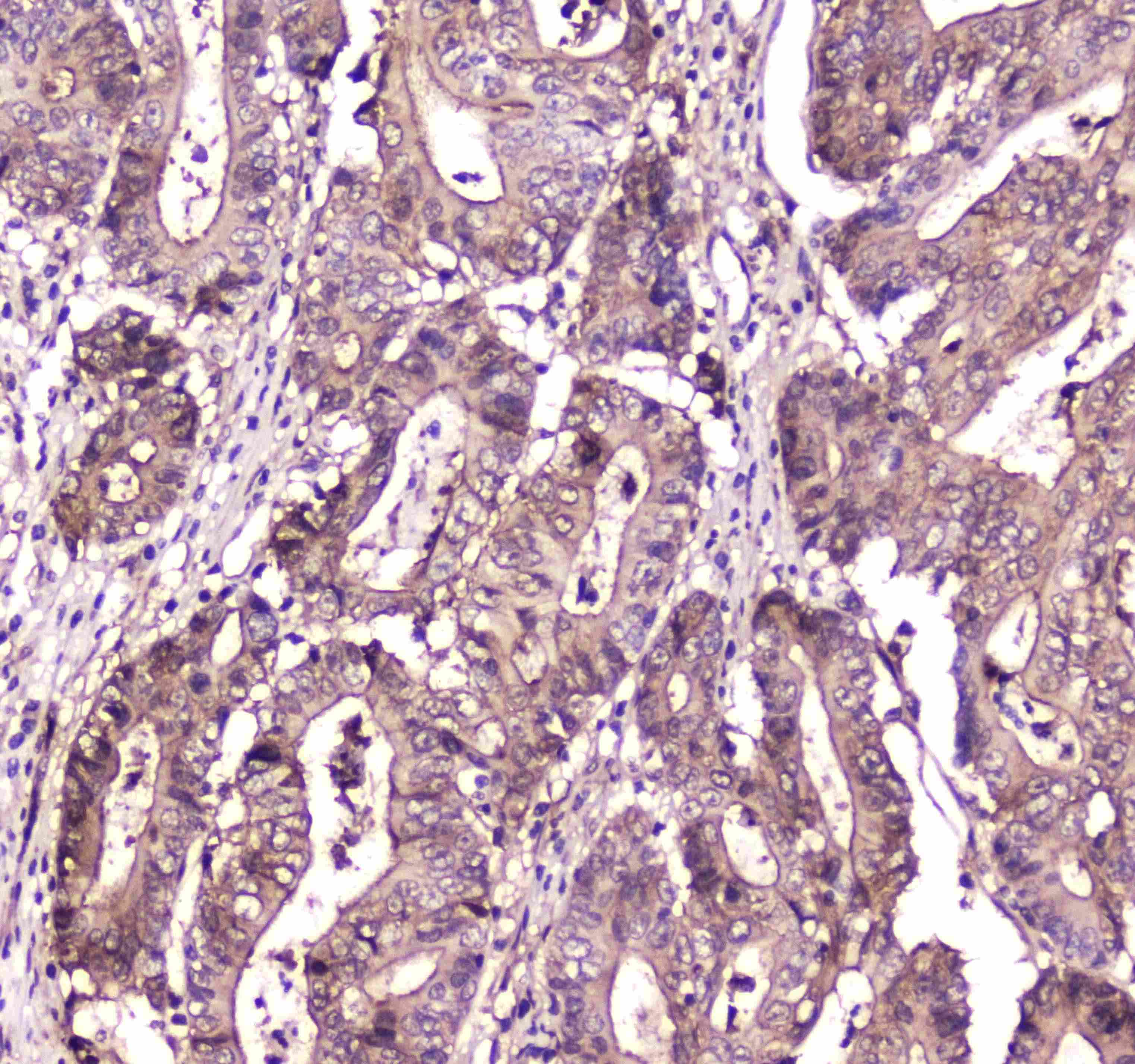 S100A10 Antibody