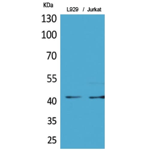 E2F4 Antibody (acetylation site of K96.)